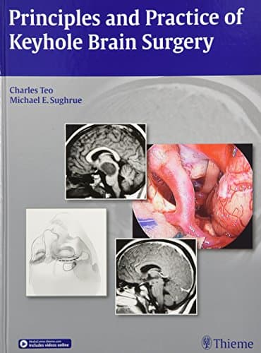 Principles and Practice of Keyhole Brain Surgery