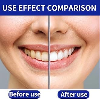 Tomedeks 28 Strips Teeth whitening Strips, Teeth whitening kit, Bamboo Charcoal