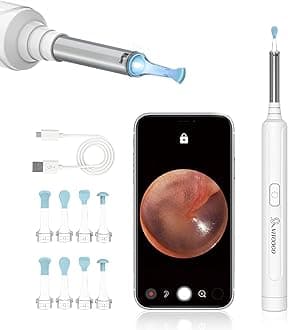 VITCOCO Ear Wax Removal Kit Ear Camera 1296P High-Definition Earwax Cleaner Portable USB Charging Visible 6 LED Otoscope for Android, iPhone, Ipad-white