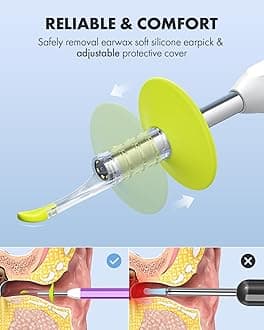 Anykit Visual Ear Wax Removal Camera, Type-C Digital Otoscope with 6 LED Lights and Ear Camera with Earwax Removal Tool for Adults & Children, Compatible with iPhone 15& Android (Purple)