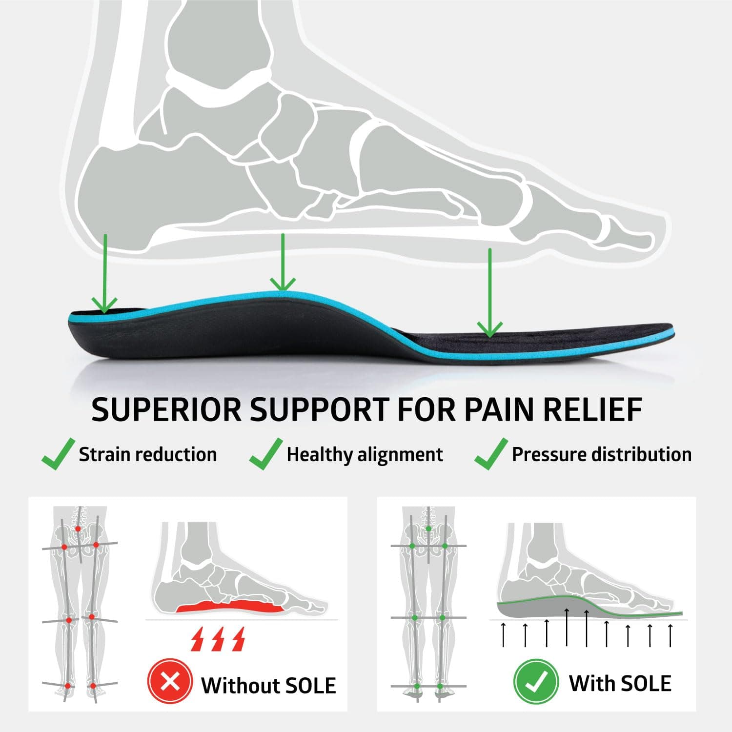 SOLE Active Thick Insoles - Custom Moldable Orthotic Support for Any Arch Type, Plantar Fasciitis Relief - Multiple Sizes
