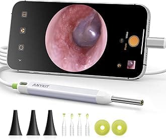 Anykit Visual Ear Wax Removal Camera, Type-C Digital Otoscope with 6 LED Lights and Ear Camera with Earwax Removal Tool for Adults & Children, Compatible with iPhone 15& Android (White)