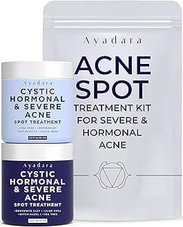 Ayadara Day & Night Cystic Acne Spot Treatment, Hormonal Acne Treatment For D...